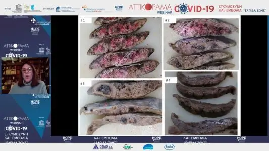covid kai endometrios embryikos